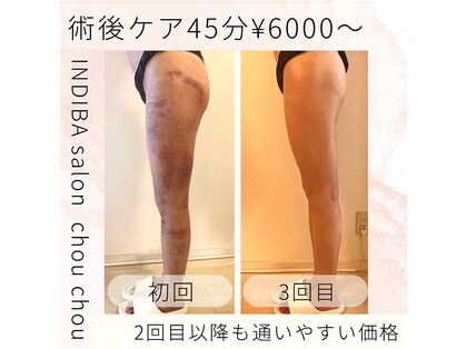 シュシュの写真