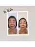 【初回半額】たるみ／ほうれい線が気になる方の為のフェイシャル