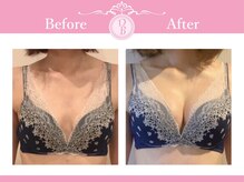 デミーナ(Demyna)/