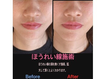 美容矯正サロン レレポノ(LELEPONO)/