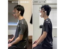 ジェイミープラス 表参道(J‘aimee +)/肩凝りビフォーアフター