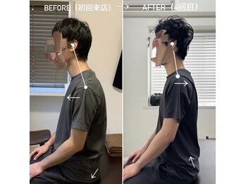 ジェイミープラス 表参道(J‘aimee +)/肩凝りビフォーアフター