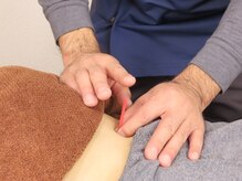 あすなろ鍼灸整骨院/ダイエット鍼灸施術