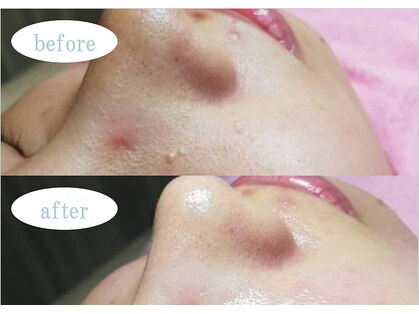 エイジングケア専門店 イエス(YES)の写真