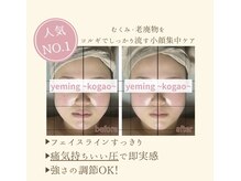 エミング(yeming)の雰囲気(満足度人気No1♪小顔コルギでフェイスライン、歪みをスッキリ!)