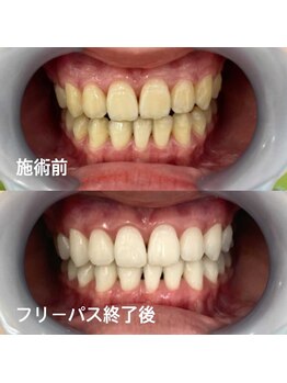 アイブロウ33/ホワイトニング　