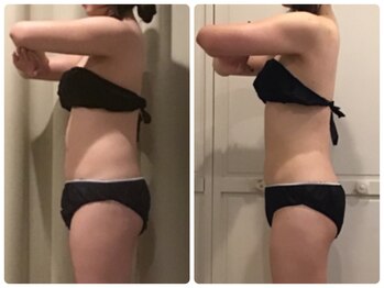 クランシュプール 恵比寿店/【ダイエット/二の腕】