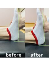 オアボディ(orBody)/姿勢改善ビフォー・アフター5