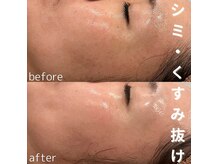 アンジェーム(ANGEAME)の雰囲気（くすみが抜けるだけで別人級の印象に♪正しいイン・アウトケアを）