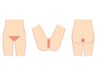 VIO脱毛 ￥6,000 ☆何度通っても同じ価格♪