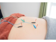 幸鍼灸整体院 武庫之荘院/電気鍼で痛みを和らげる【腰痛】