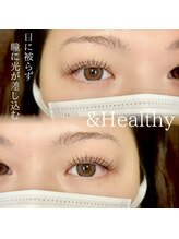 クレー(Klee)/アンドヘルシー