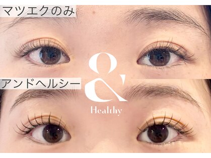 リム(Lim)の写真