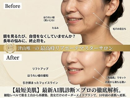 ラウレア(Laule'a)の写真