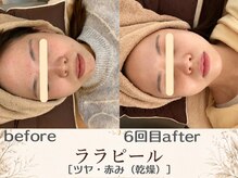 エスポワール(espoir)/before・after