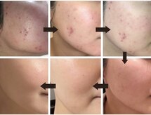 アイル 金山店(iru)