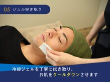 ロペス(Lopez)/施術後の肌をしっかりケア