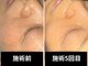 レイル(REIR)の写真