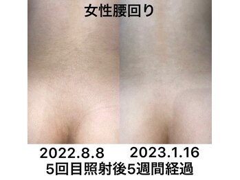 クリア アイラッシーズ アンド ネイルサロン シャイン(CLEAR & SHINE)/