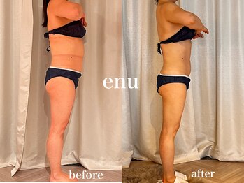 エヌ 白金台(enu)/厚みを減らしたい方に