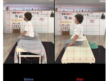 ストレチックス 近江八幡店/BeforeAfter