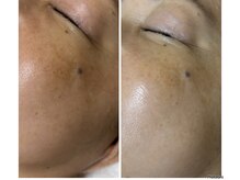 ルビー(RUBY)/トーンアップで透き通るお肌に