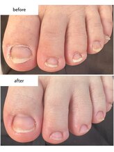 ケアプラス(care plus)/フットネイルケア