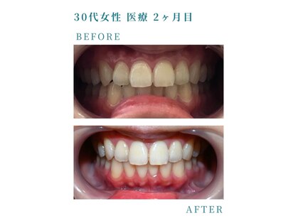 ミノリ(MINORI)の写真