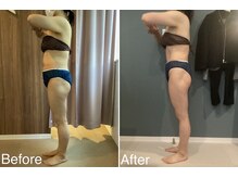 サンニロク(326)/４０代のお客さま/２回施術