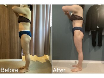 サンニロク(326)/40代のお客さま/2回施術