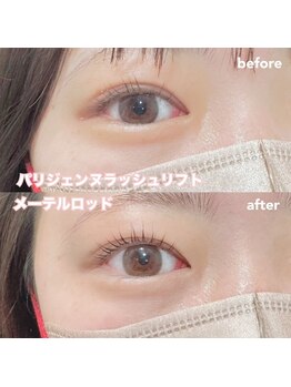 レディエント(Radiant)/パリジェンヌ/メーテルロッド