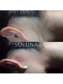 ソルーナ ブラジリアン ワックス 脱毛(SOLUNA)/リピートしやすい値段設定☆