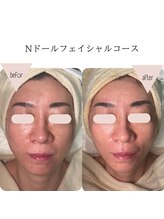 ソワ 恵比寿(soi)/Nドールフェイシャル