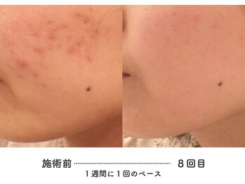 あるしあ鍼灸接骨院 木曽川院/〈一宮/木曽川町/岐阜/整体〉