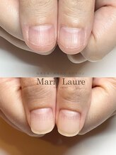 マリーロール 淀屋橋本店(Marie Laure)/自爪育成/深爪矯正/ネイルケア
