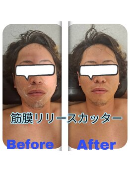 エトワール(Etoile)/フェイシャル