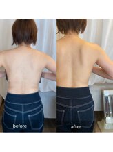 ナイスデイ(Niceday!)/肩甲骨周りスッキリ