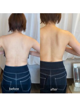 ナイスデイ(Niceday!)/肩甲骨周りスッキリ