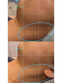 マシロ(MA SHIRO)/マッサージ+筋膜リリース