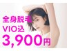【全身脱毛】VIO込み／1周年特別価格！（VIO→顔脱毛に変更可能★）