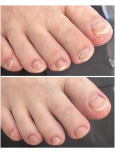 ケアプラス(care plus)/フットネイルケア