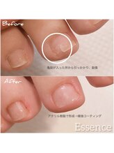 エッセンス (Essence)/足爪リペア(補修)もお気軽に○