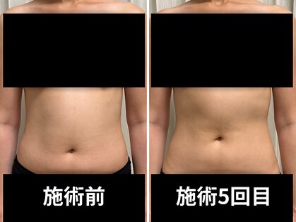 レイル(REIR)の写真
