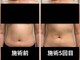 レイル(REIR)の写真