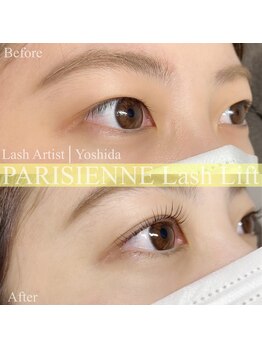 ネイルアンドアイラッシュ アリア(Alia)/ビフォーアフター