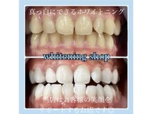 ホワイトニングショップ 柏店/美白ホワイトニング