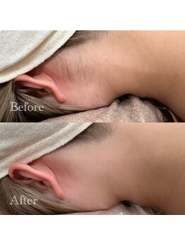 コラソン(CORAZON)/襟足サイドもスッキリ♪