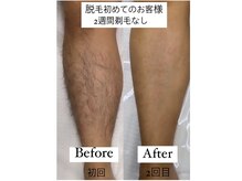ルウム 藤が丘店(lum)の雰囲気（〈メンズ脱毛可〉ヒゲ脱毛・全身脱毛・VIO脱毛などで清潔感を）