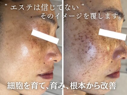 リプラス(RE.PLUS)の写真