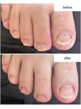 ケアプラス(care plus)/フットネイルケア